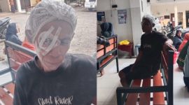 Hasanudin, warga Desa Saseel, Kecamatan Sapeken, Kabupaten Sumenep, terpaksa tinggal di kamar kos sederhana di depan Museum Sumenep usai menjalani operasi katarak.